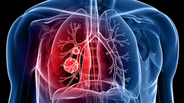 Sağlık yetkilileri uyardı: Vakalar rekor seviyeye ulaştı... Yeni bir salgın kapıda mı?