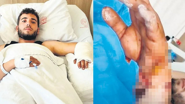 Ankara'da köpek dehşeti: MS hastası genç ağır yaralandı! Babası kalp spazmı geçirdi