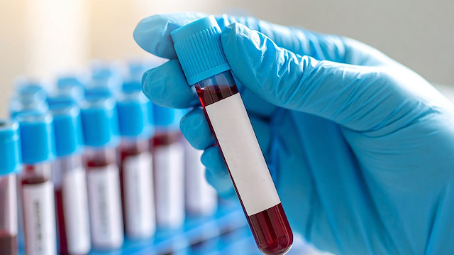 Erken teşhiste yeni dönem: Kan testi ile 50 farklı kanser türü tespit edilebiliyor