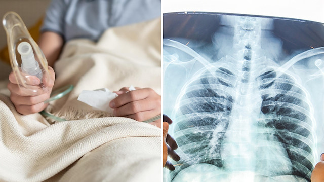 Zatürre tekrar ediyorsa dikkat: Uzmanlar sinsi tehlikeye dikkat çekti