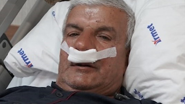 Yıllardır nefes alamıyordu: Burnundan çıkan doktorları şaşkına çevirdi!