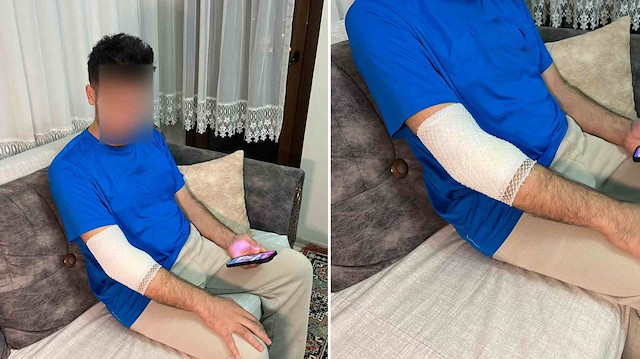 Başakşehir’de sahipli köpek saldırısı! Sitenin güvenlik görevlisi hastanelik oldu