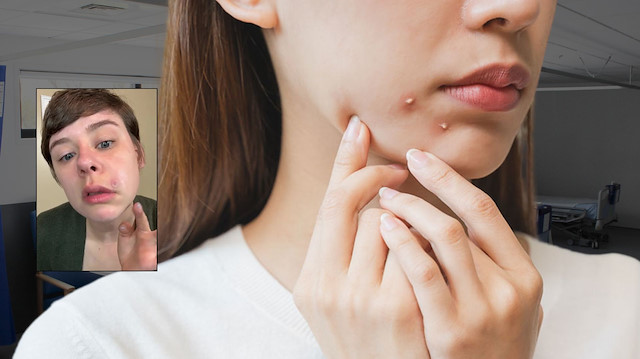 Sivilcenizi sıkmadan önce bir daha düşünün! Genç kadın neredeyse canından oluyordu