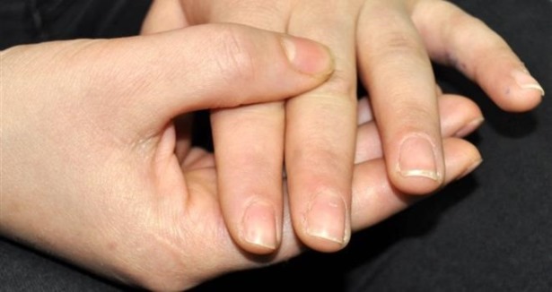 Tırnaklarınızdaki değişime dikkat !