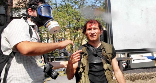 Gazetecileri dövdüler muhabirimiz yaralandı