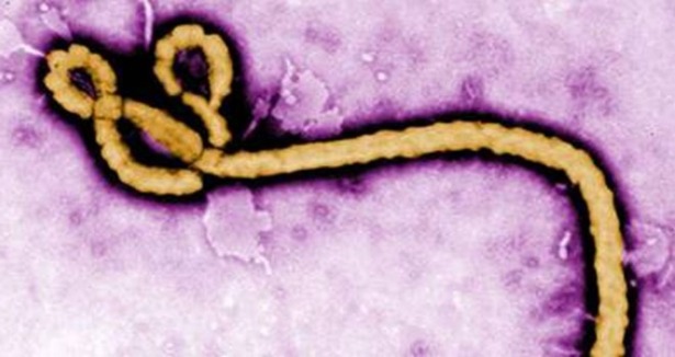 Sağlık çalışanlarına ebola virüsü uyarısı