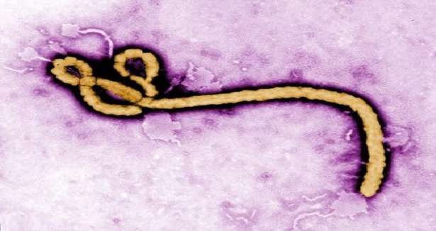 Ebola virüsü iş dünyasını tehdit ediyor