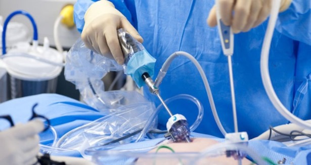 Robotik cerrahiyle kalp ameliyatı