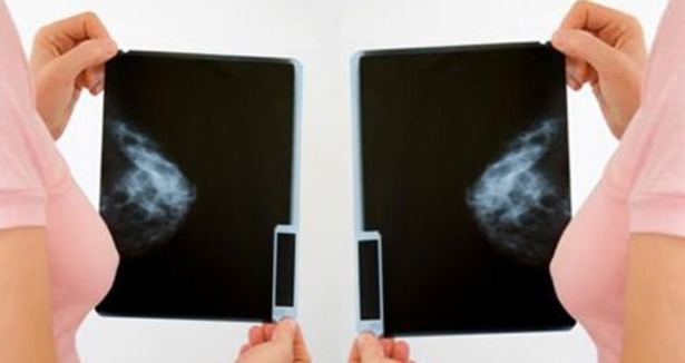 Meme hastalıklarının tanısında Mamografi 
