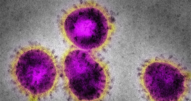 Kanada'da Ebola virüsü şüphesi