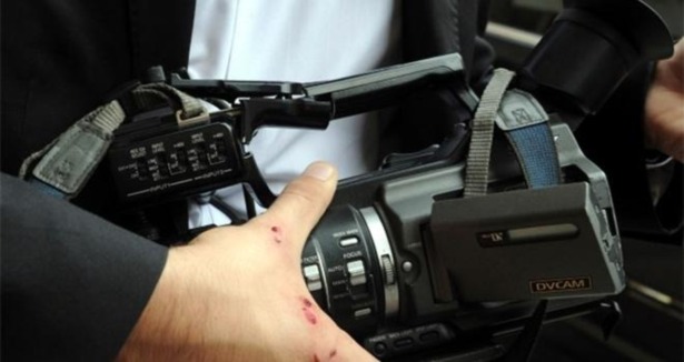 Brezilya'da gazeteci saldırıya uğradı