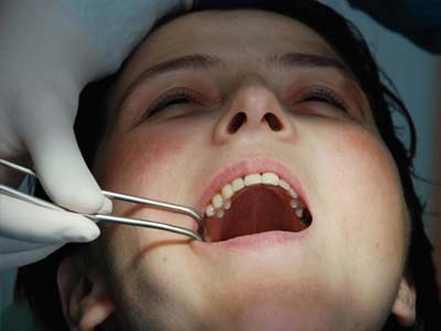 Basit yöntemlerle diş çürükleri önlenebilir