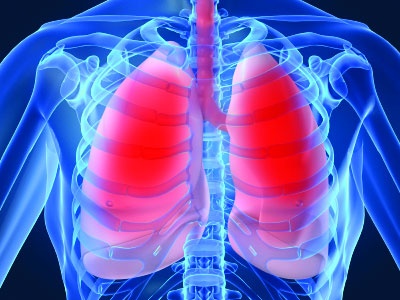 Akciğer kanseri hastaları için kişiye özel ilaç