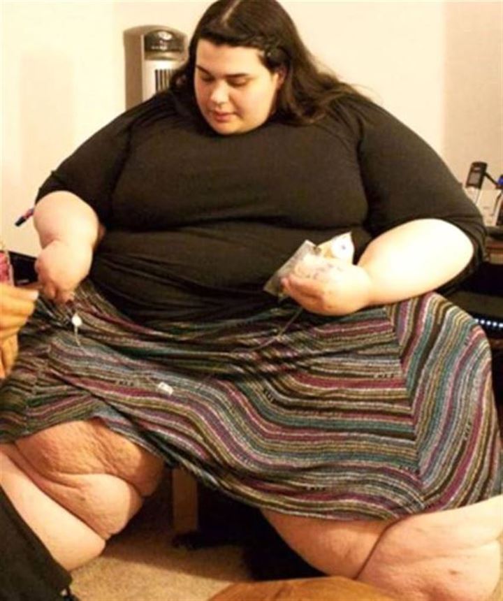 Even surpassing the super obese scale, the 24-year-old woman became housebound.