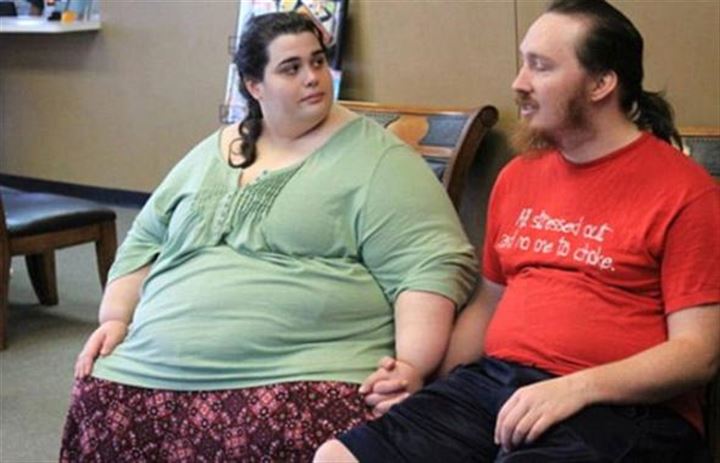 After doctors told Amber that she wouldn’t make it to 30 if she continued like this, she decided to undergo surgery.