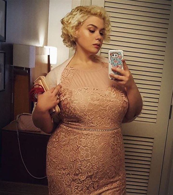 Amber had to lose some weight for her gastric bypass, so with hard work she achieved her goal.