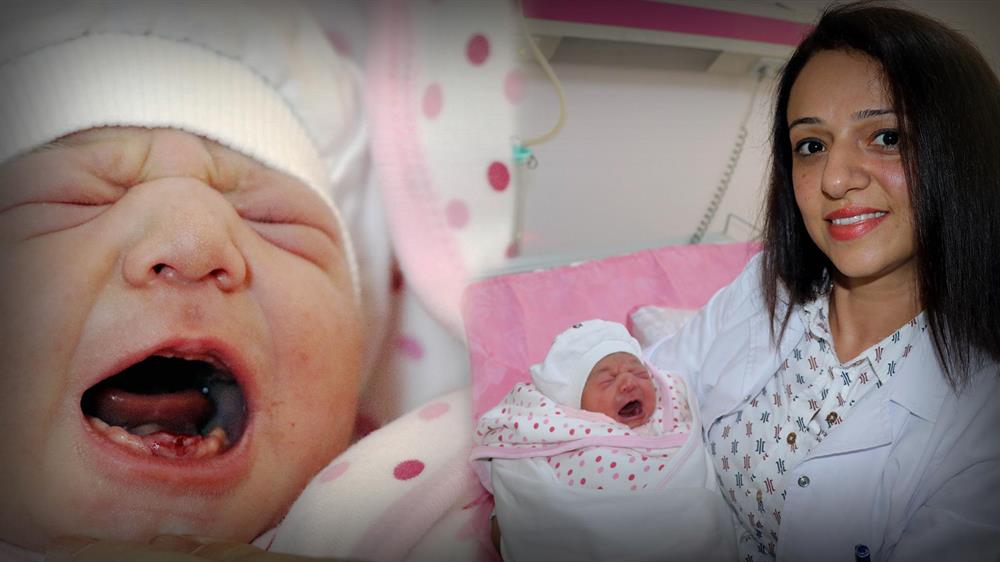 dokuz disli dogan bebek gorenleri sasirtti