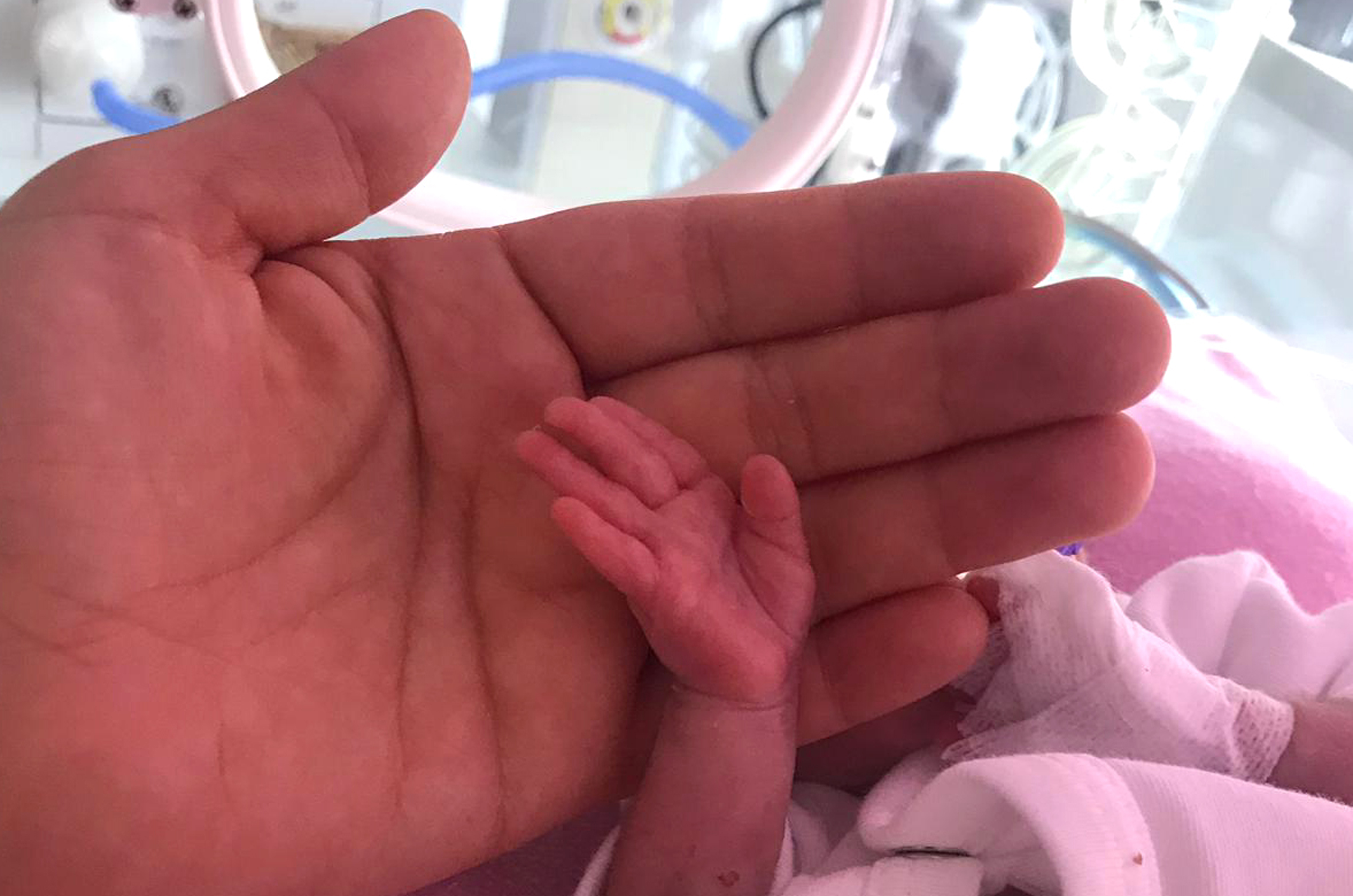 Tup Bebek Tedavisinde Dogru Bilinen Yanlislar