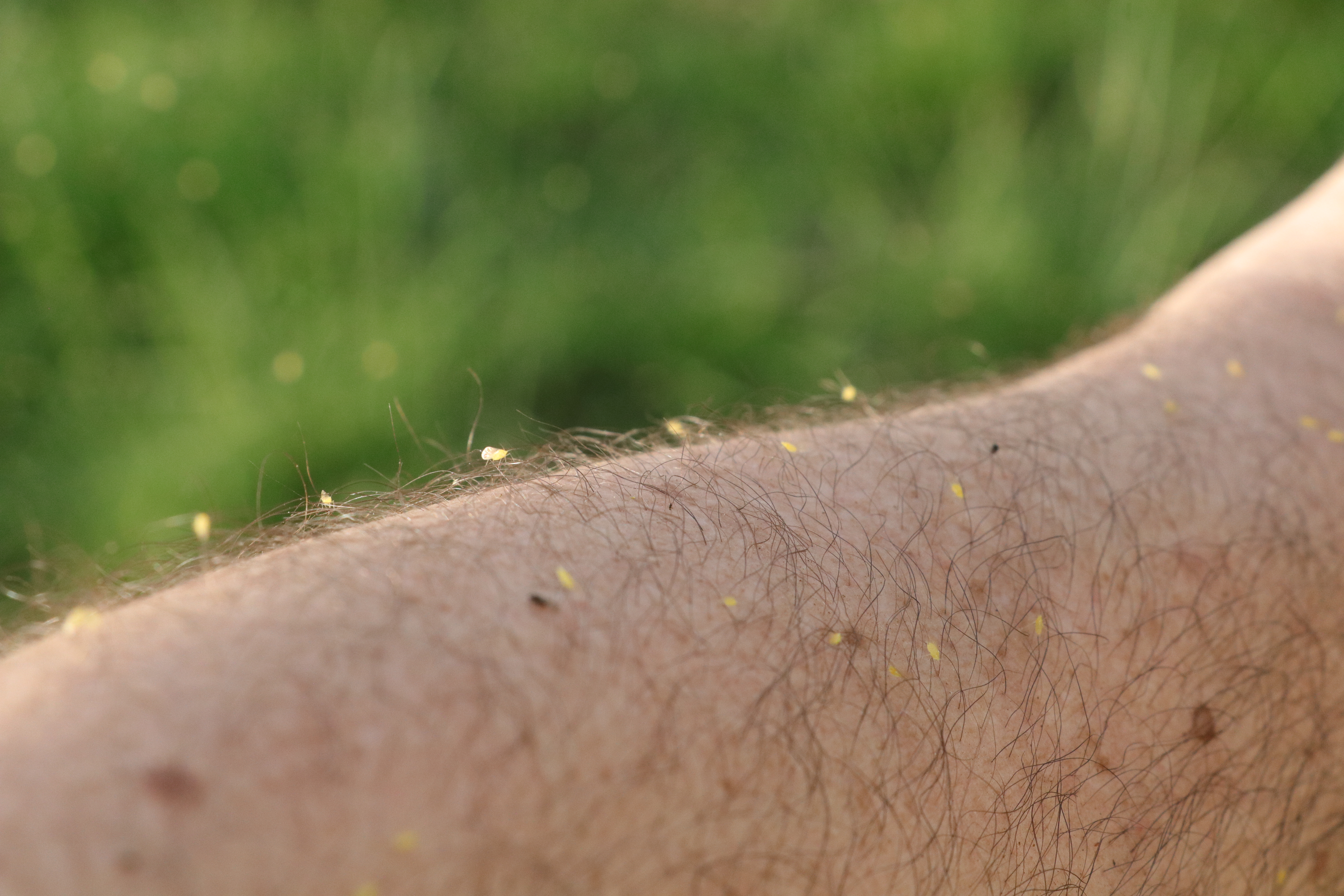 Yozgat�ta bir köy sinek istilasına uğradı Yozgat Yozgat�ta bir köy sinek istilasına uğradı Yozgat