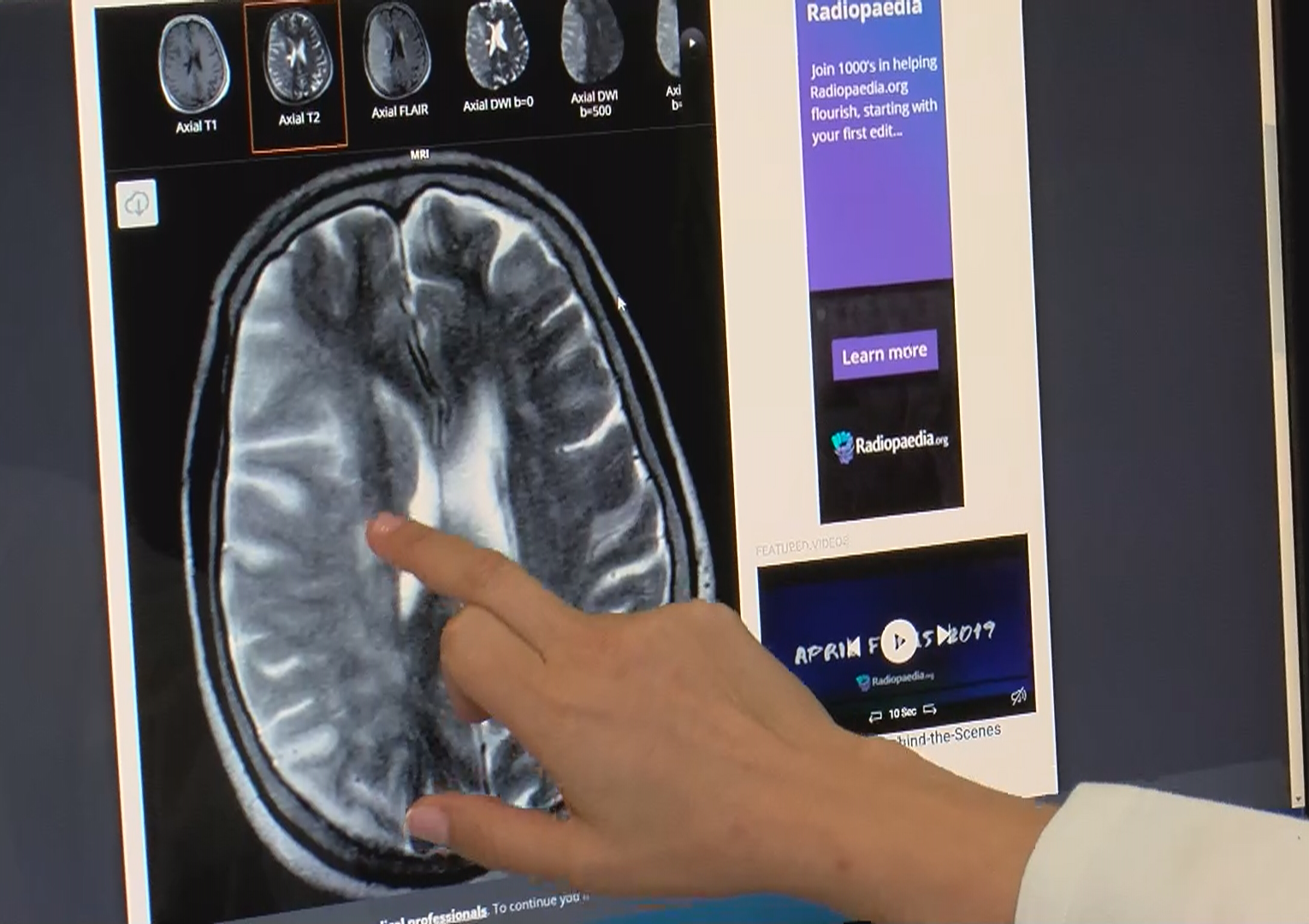 koronavirusu belirtisiz gecirenler dikkat buyuk risk altindasiniz