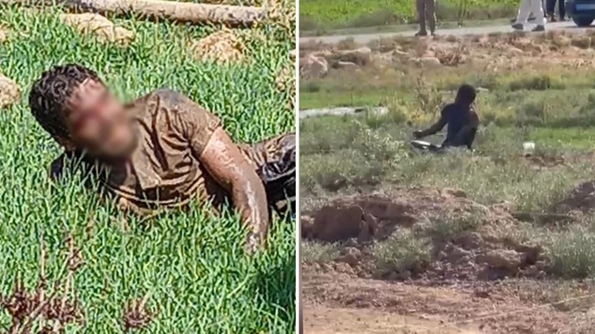 Şanlıurfa'da kuduz hastası hastaneden kaçtı